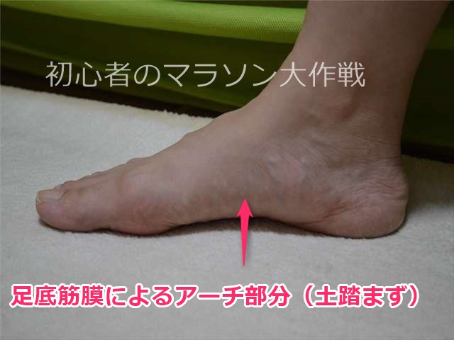 足底筋膜炎、足底腱膜炎になる原因は？