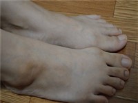 ランニング後に足の爪が剝がれてしまう原因と対策